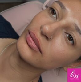 Natural Lip Enhancement by Kiss