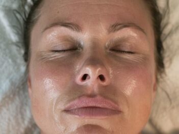 fine-lines-wrinkles-kiss