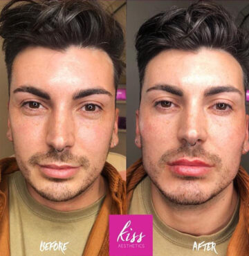 kiss-male-masc1