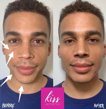 kiss-male-masc3