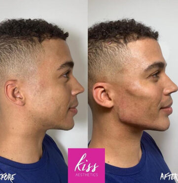 kiss-male-masc4