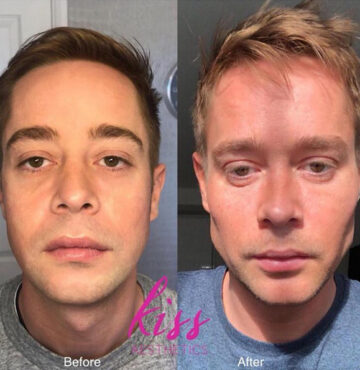 kiss-male-masc6