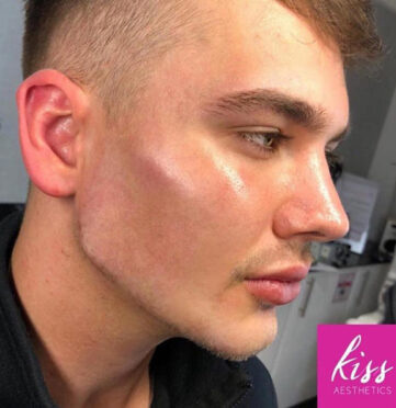 kiss-male-masc7