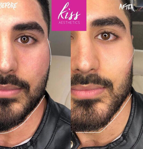 kiss-male-masc9